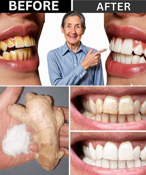 Simple Natural Remedy for Soothing a Sore Throat