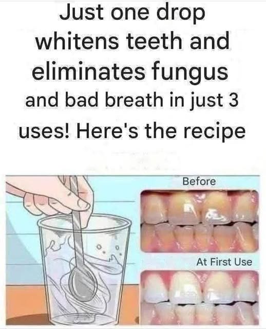 How to Reduce Tartar from Your Teeth Naturally