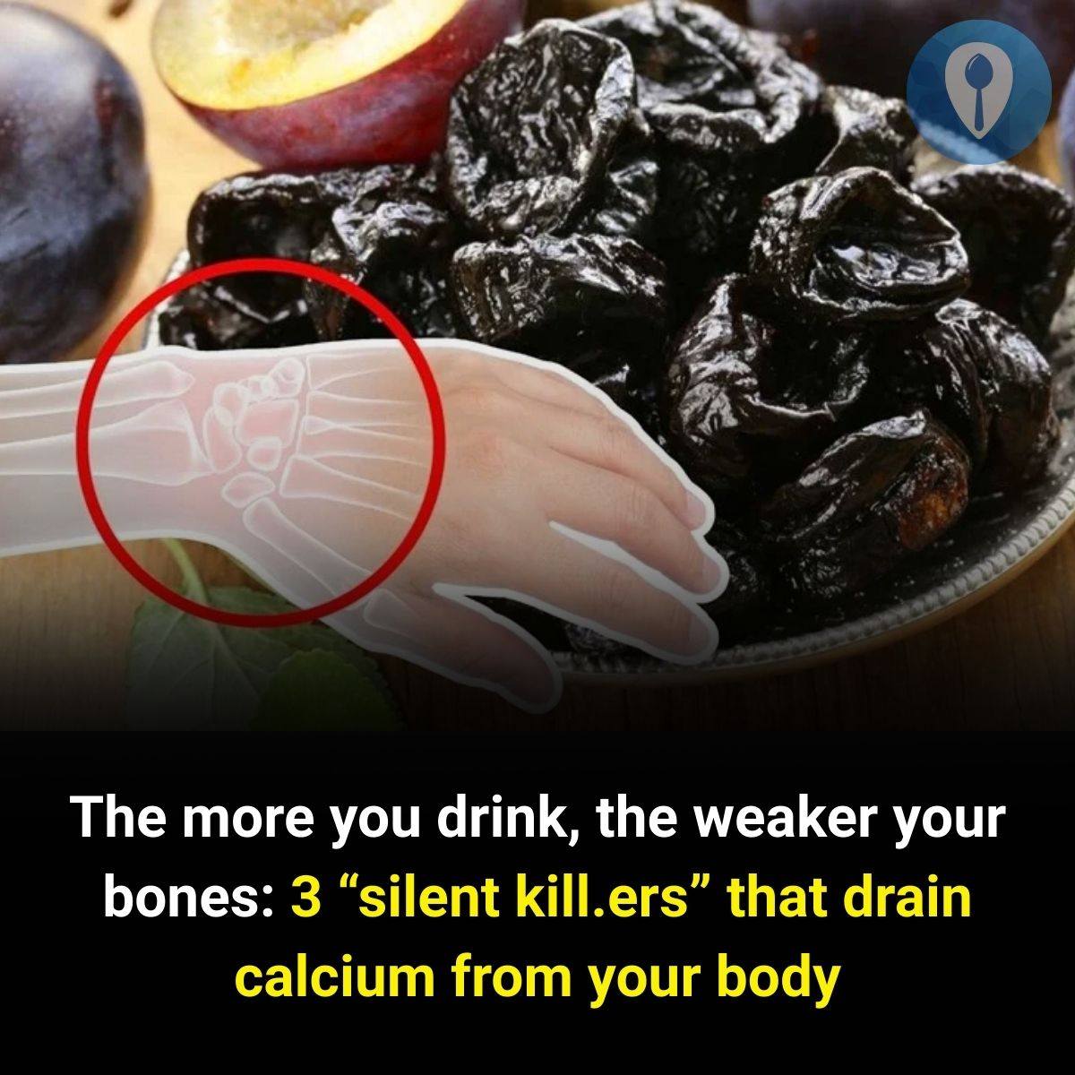 3 Hidden Dangers That Secretly Drain Calcium and Weaken Your Bones