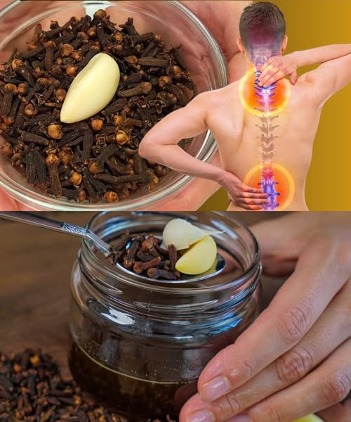 Clove and Garlic Remedy for Joint Pain, Arthritis, and Rheumatism