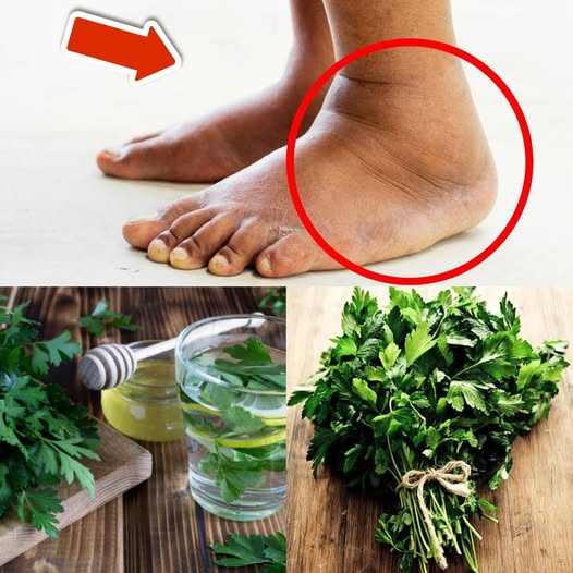 Parsley Benefits for Swollen Feet: A Simple Home Remedy