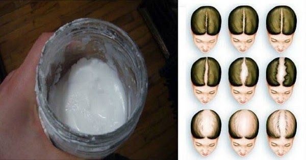 Baking Soda Shampoo: A Simple DIY Recipe for Healthier Hair