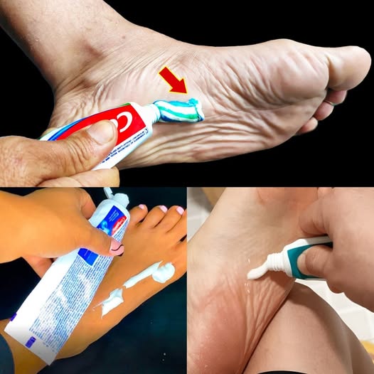 Refresh and Soothe Your Feet with Toothpaste: A Simple Home Remedy