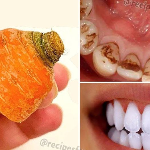DIY Carrot Top Teeth Whitening Paste: A Natural Remedy You Can Make at Home