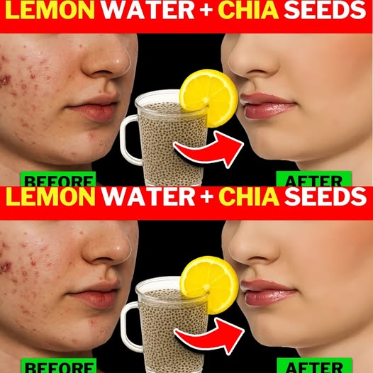Drink Chia Seeds with Lemon in the Morning for Better Skin