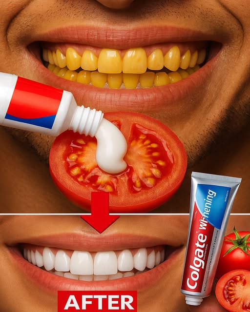 Healthy Recipe for Whitening Teeth