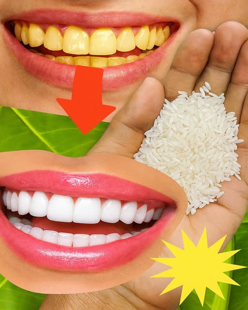 Can Rice Help Whitening the Teeth?